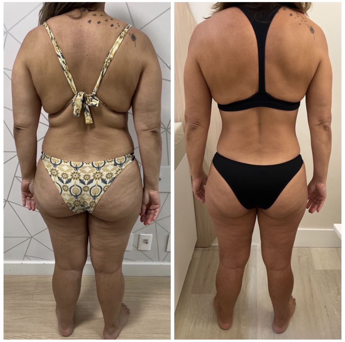 Comparação antes e depois — evolução de composição corporal